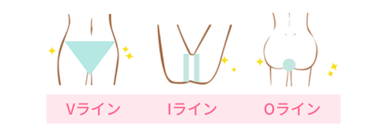 レジーナクリニックデビュープランVIO